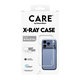CARE - Puzdro X-Ray pre iPhone 18 Pro/17 Pro, transparentná